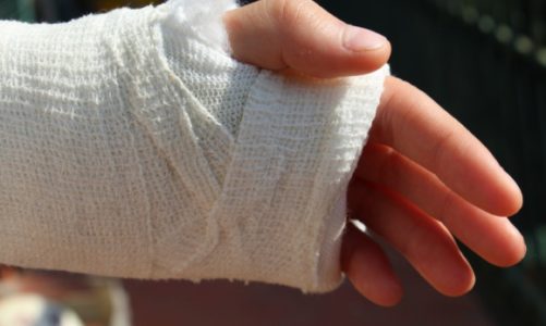 Czy polisa szkolna zadziała, gdy do wypadku dojdzie podczas zabawy w domu?